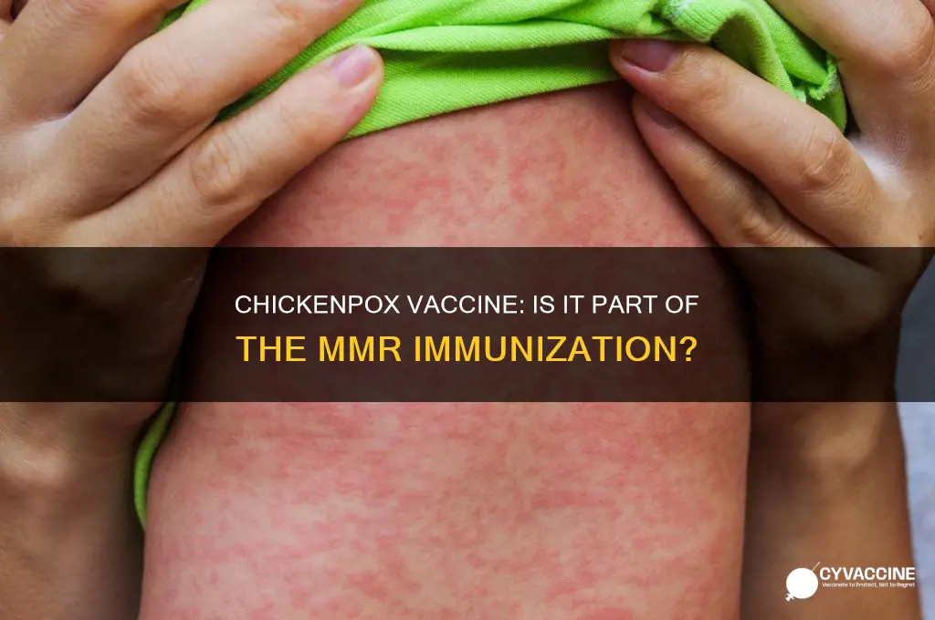 is the chickenpox vaccine included in the mmr