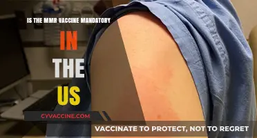 Is the MMR Vaccine Mandatory in the US? Key Facts