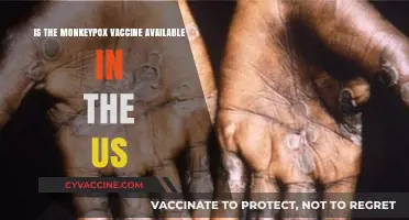 Monkeypox Vaccine Availability in the US: What You Need to Know