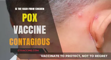 Is the Chickenpox Vaccine Rash Contagious? Facts You Need to Know