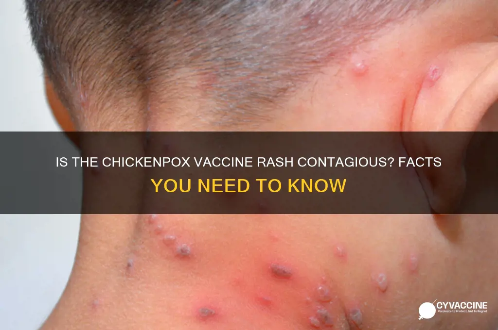 is the rash from chicken pox vaccine contagious
