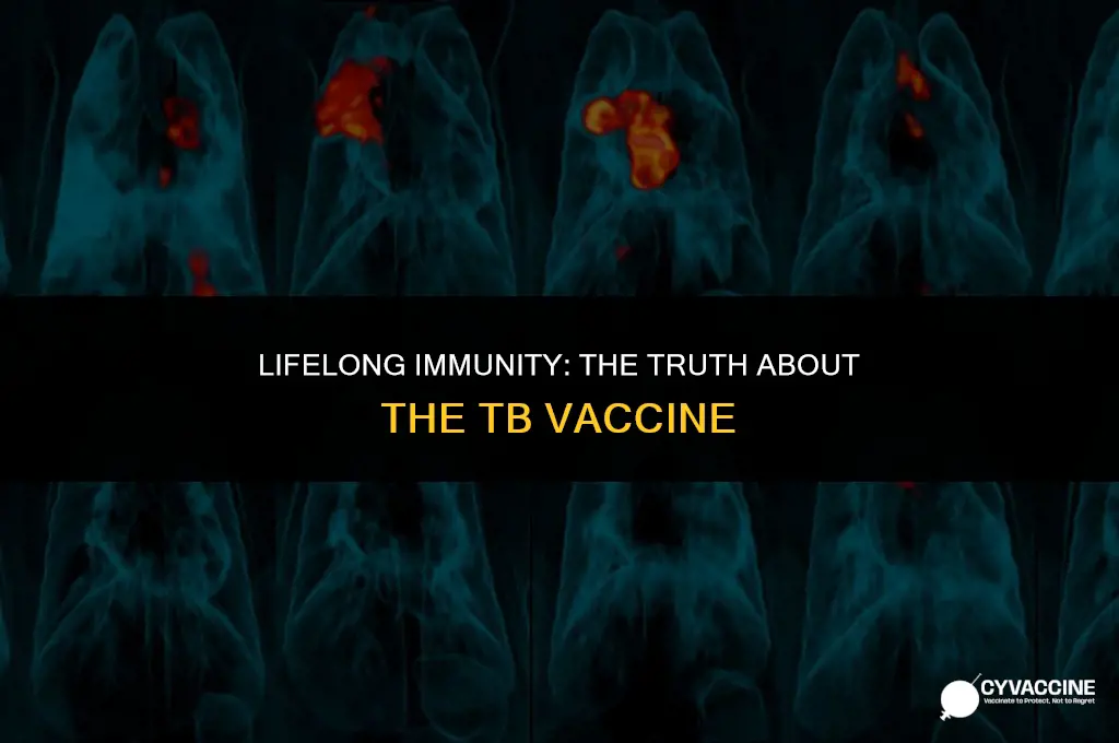 is the tb vaccine for life