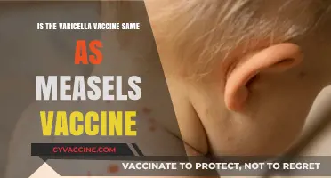 Varicella vs. Measles Vaccine: Are They the Same or Different?