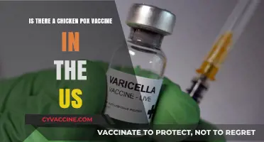 Chicken Pox Vaccine in the US: Availability and Importance