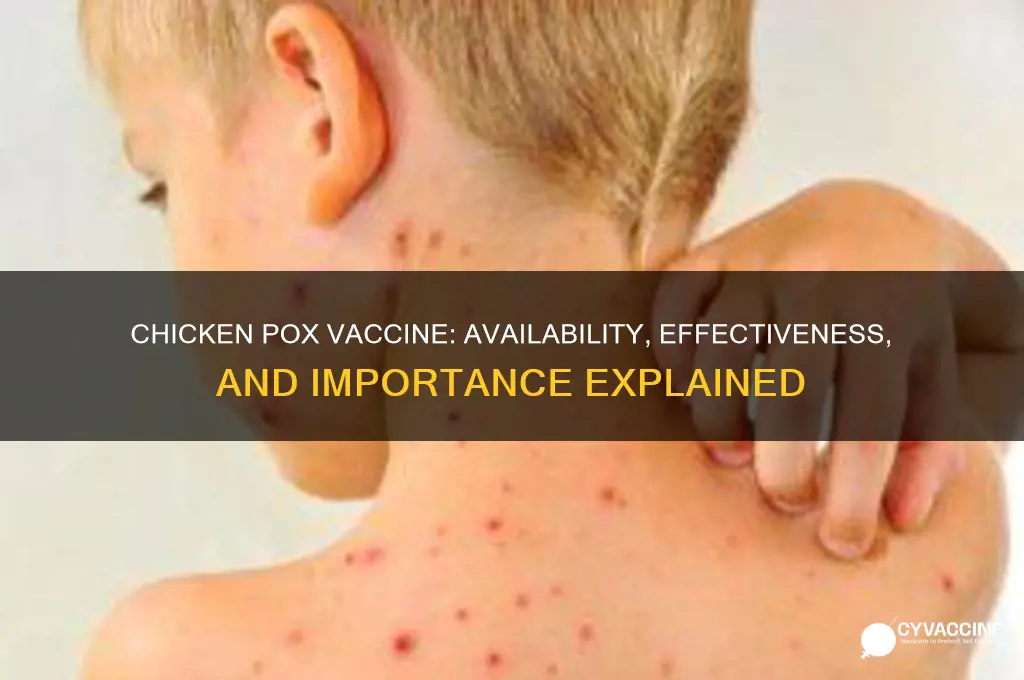 is there a chicken pox vaccine
