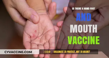 Hand, Foot, and Mouth Disease: Vaccine Availability and Prevention Tips