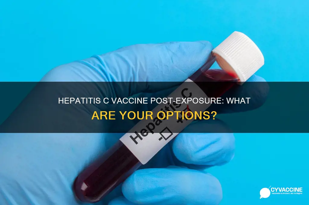 is there a hep c vaccine after exposure