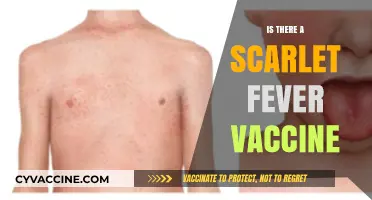 Scarlet Fever Vaccine: Current Status and Prevention Strategies Explained