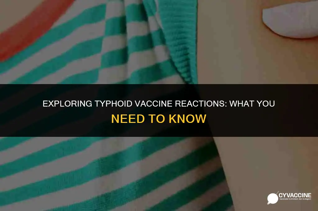 is there a typhoid vaccine reaction