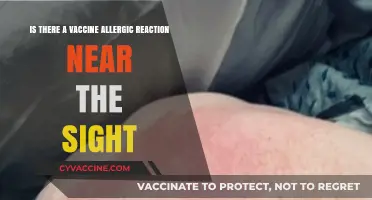Vaccine Allergic Reactions: Localized Symptoms and What You Need to Know