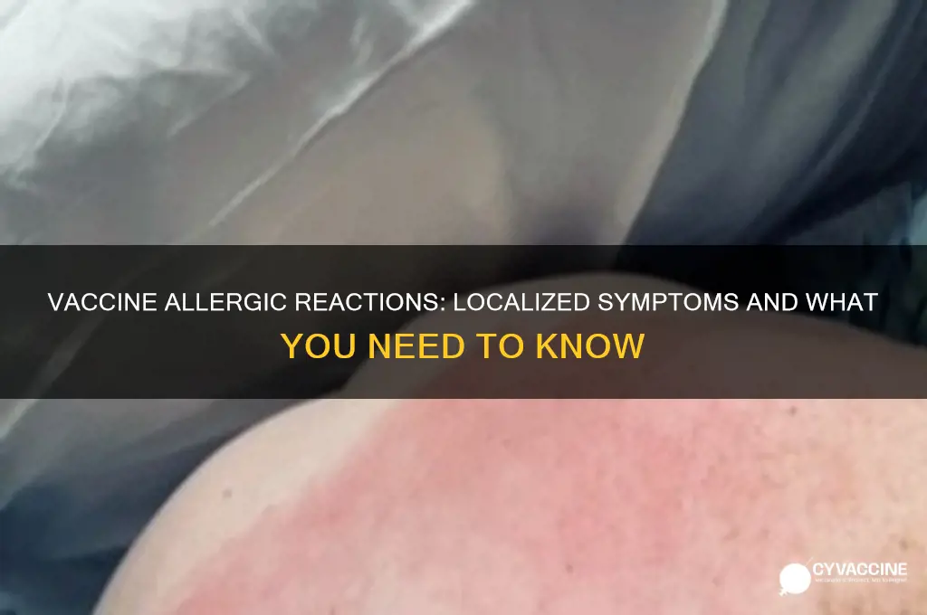 is there a vaccine allergic reaction near the sight