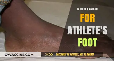 Can a Vaccine Cure Athlete's Foot? Exploring Treatment Options