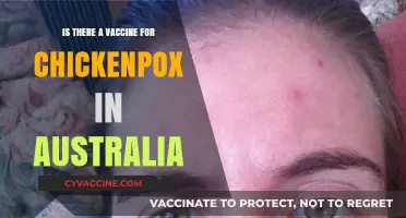 Chickenpox Vaccine in Australia: Availability, Effectiveness, and Importance