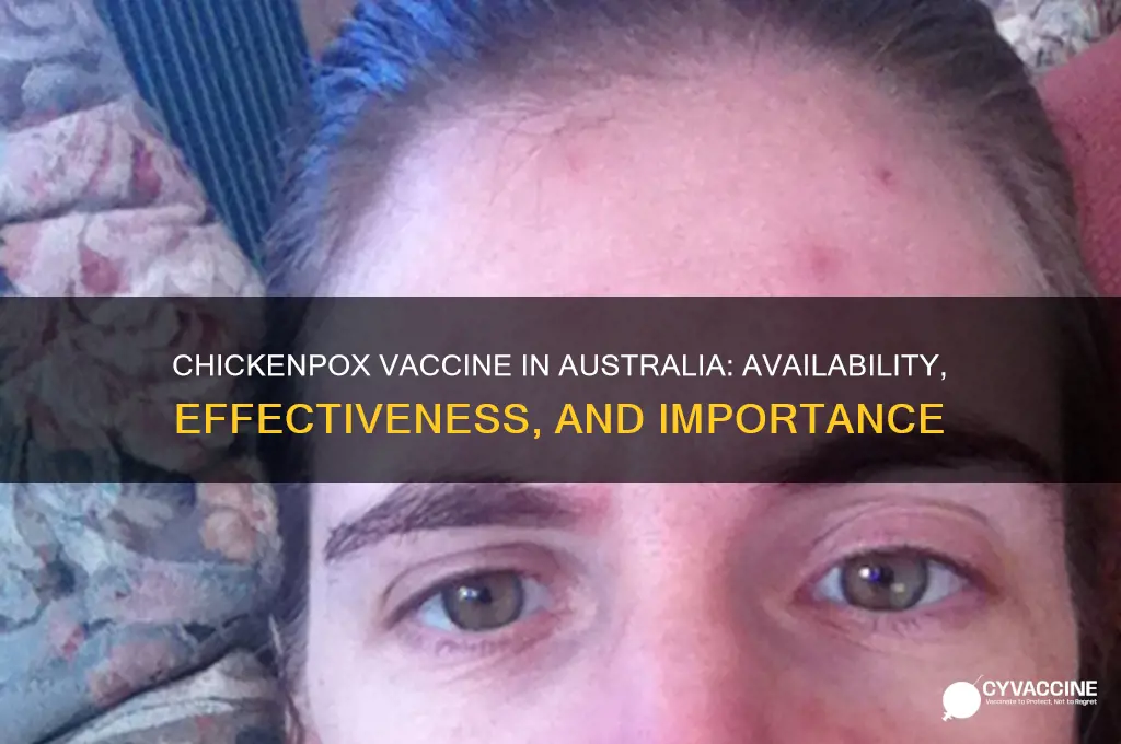 is there a vaccine for chickenpox in australia