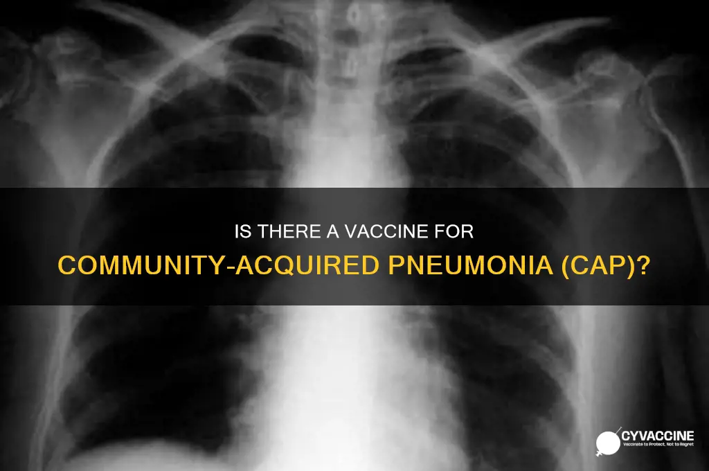 is there a vaccine for community-acquired pneumonia cap