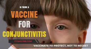 Exploring the Possibility: Can We Vaccinate Against Conjunctivitis?