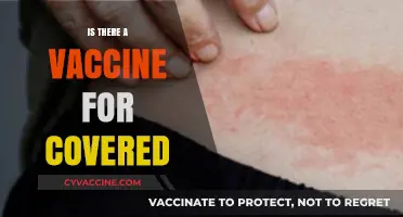Exploring the Truth: Is There Really a Vaccine for Shingles?