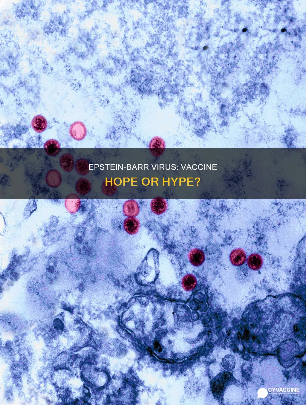 is there a vaccine for epstein barr virus