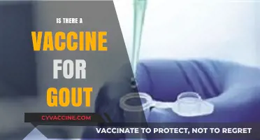 Exploring the Possibility: Is There a Vaccine for Gout?