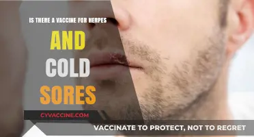 Herpes and Cold Sores: Vaccine Availability and Treatment Options