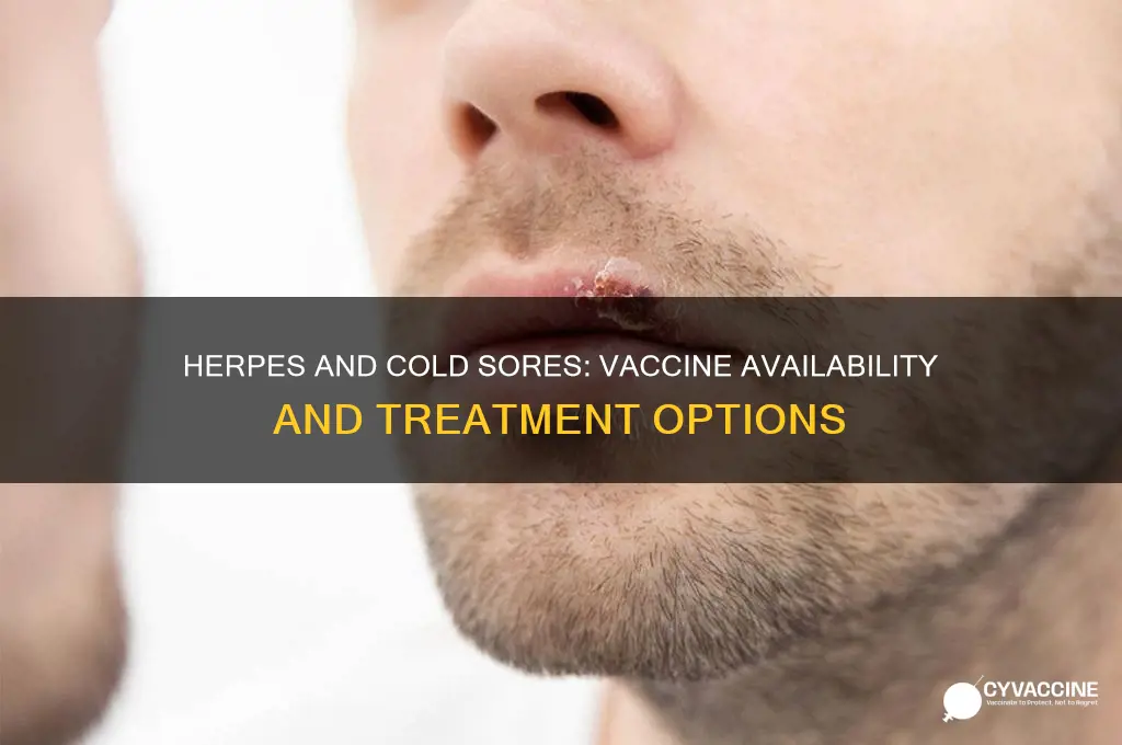 is there a vaccine for herpes and cold sores