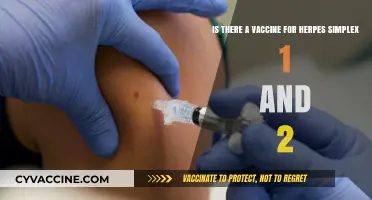 Herpes Simplex 1 & 2: Current Vaccine Developments and Hope