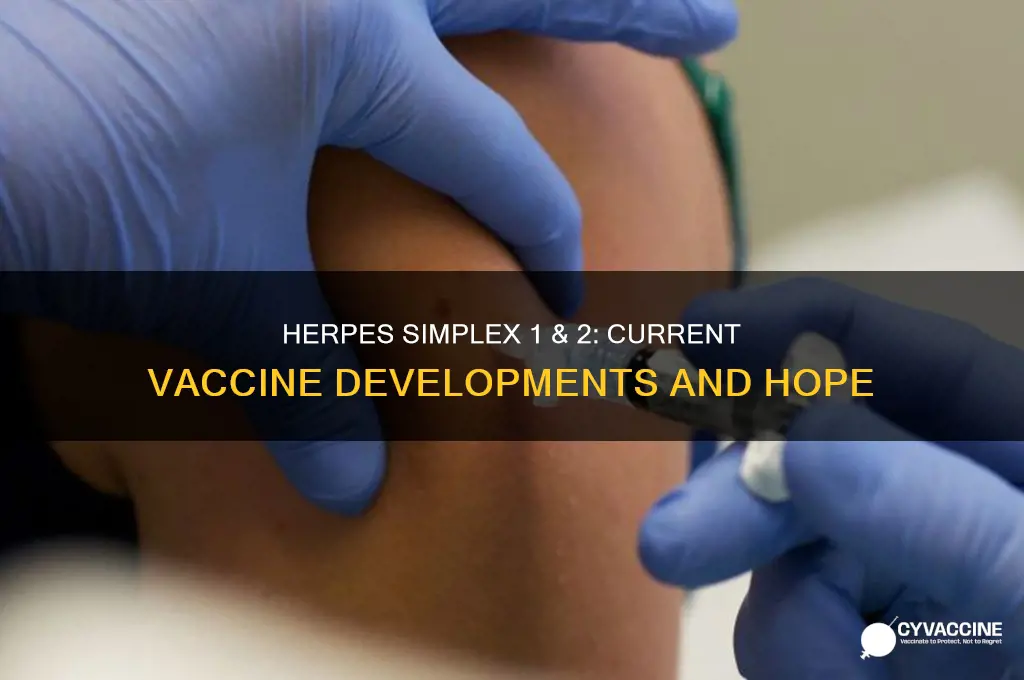 is there a vaccine for herpes simplex 1 and 2