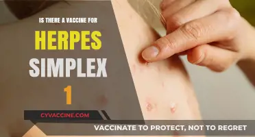 Herpes Simplex 1: Vaccine Hope or Hype?