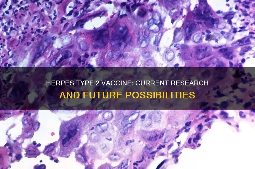 is there a vaccine for herpes type 2
