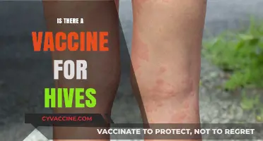 Exploring Treatment Options: Is There a Vaccine for Hives?
