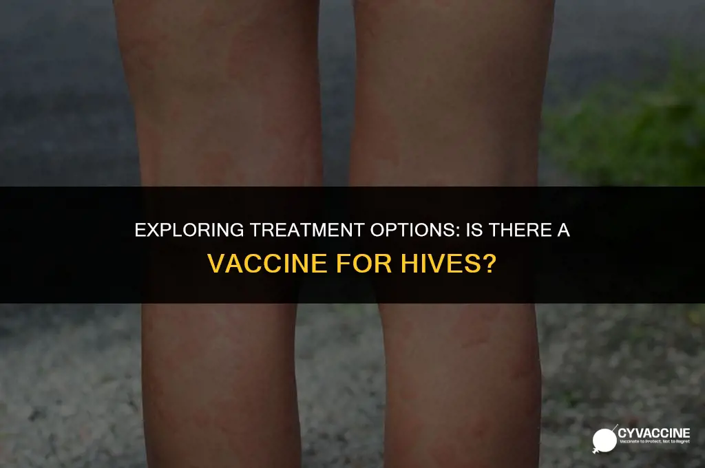 is there a vaccine for hives