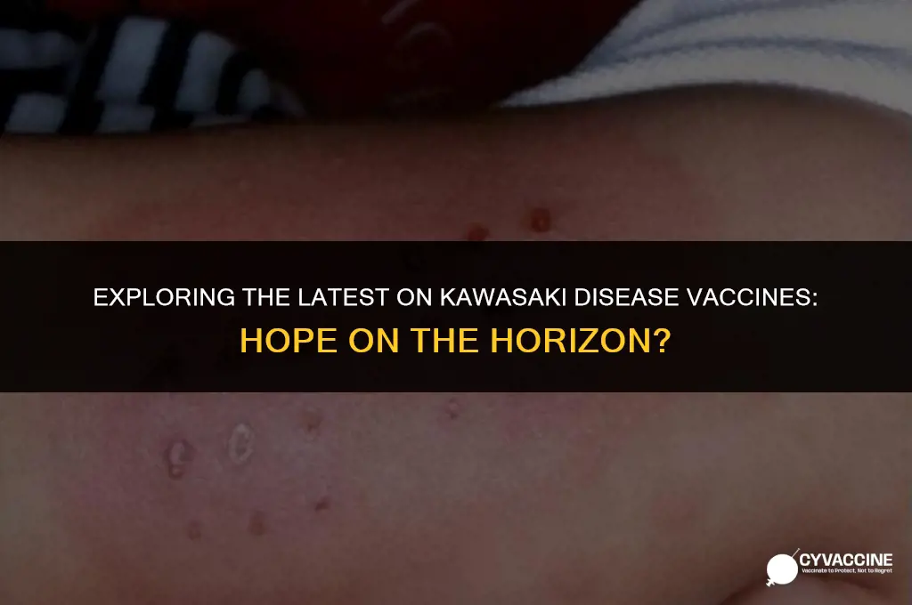 is there a vaccine for kawasaki