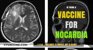 Exploring the Latest on Nocardia Vaccines: Hope or Hype?