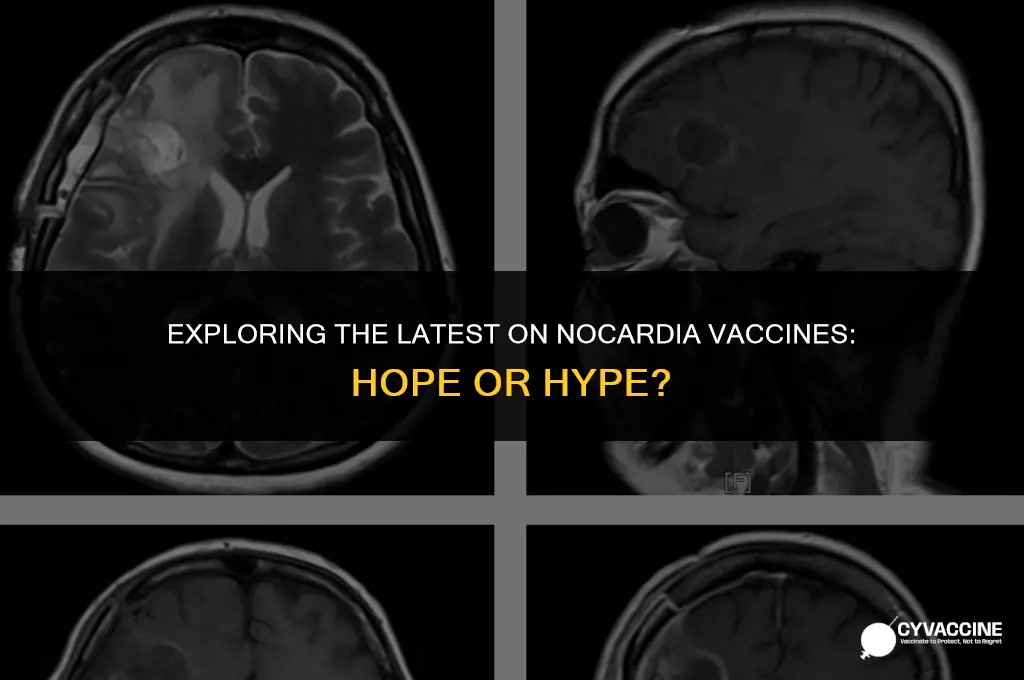 is there a vaccine for nocardia