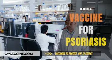 Exploring Treatment Options: Is There a Vaccine for Psoriasis?
