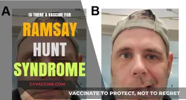 Ramsay Hunt Syndrome Vaccine: Current Research and Treatment Options