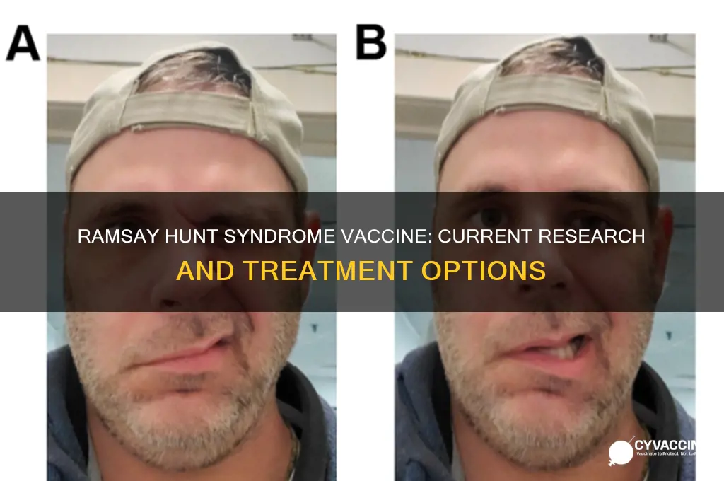 is there a vaccine for ramsay hunt syndrome