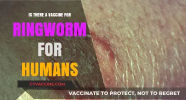 Ringworm Vaccine for Humans: Fact or Fiction? Exploring Prevention Options
