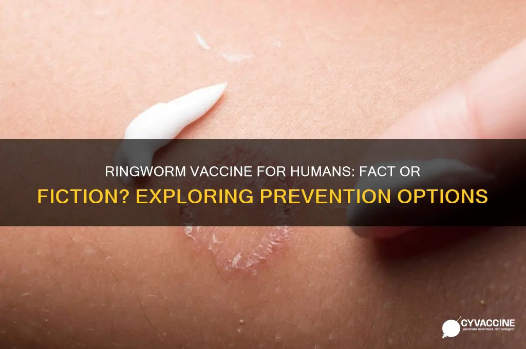 is there a vaccine for ringworm for humans