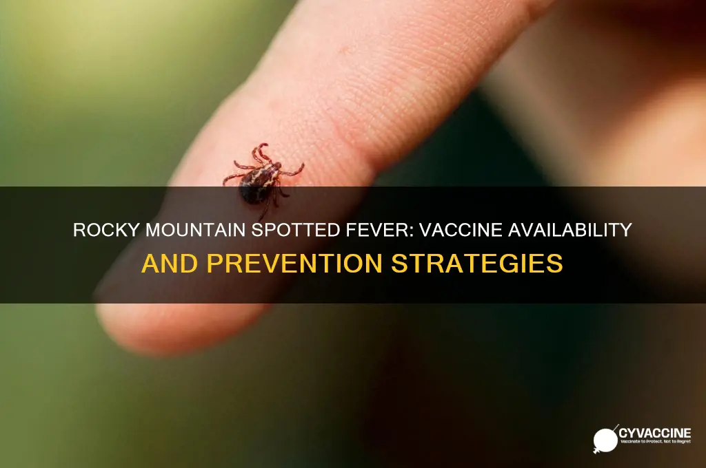 is there a vaccine for rocky mountain spotted fever