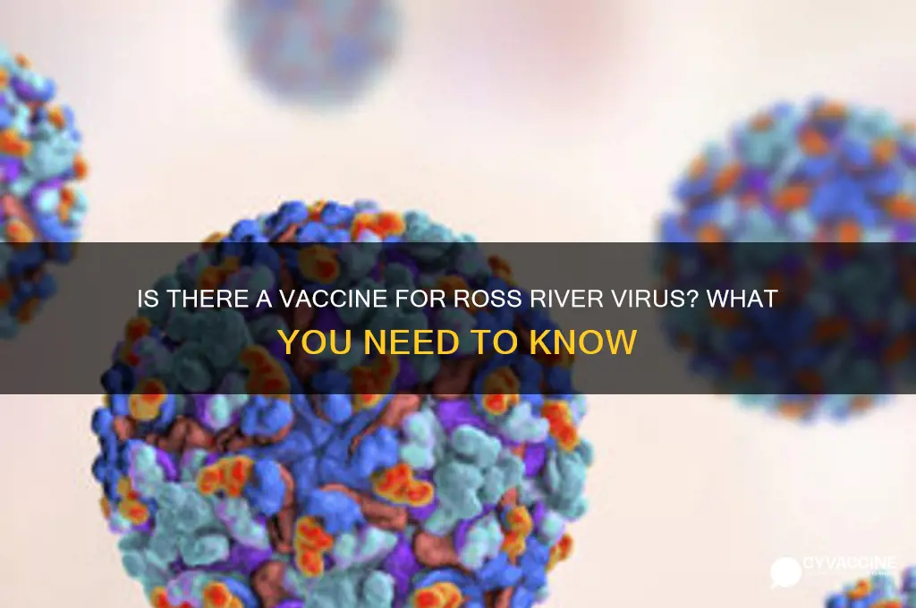 is there a vaccine for ross river virus