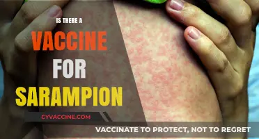 Exploring the Truth: Is There Really a Vaccine for Sarampion?