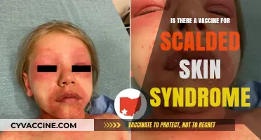 Exploring Scalded Skin Syndrome: Vaccine Availability and Prevention Strategies