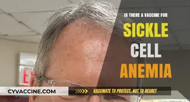 Exploring the Possibility of a Sickle Cell Anemia Vaccine
