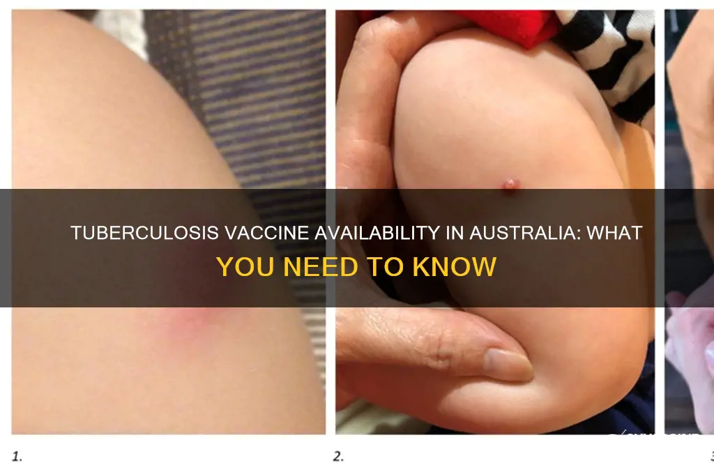 is there a vaccine for tb in australia