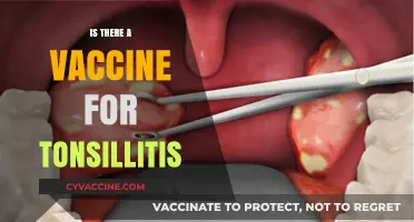 Exploring Tonsillitis Vaccination: Facts, Myths, and Prevention Strategies