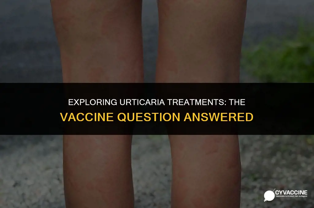 is there a vaccine for urticaria