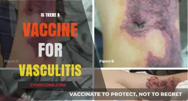 Exploring Treatment Options: Is There a Vaccine for Vasculitis?
