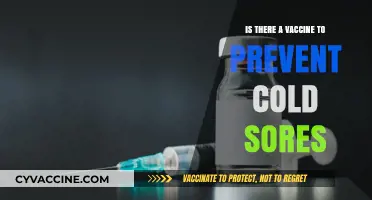 Cold Sores: Exploring Vaccine Options for Prevention and Treatment