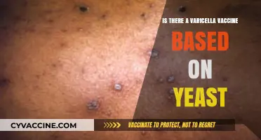Varicella Vaccine and Yeast: Unraveling the Connection and Safety